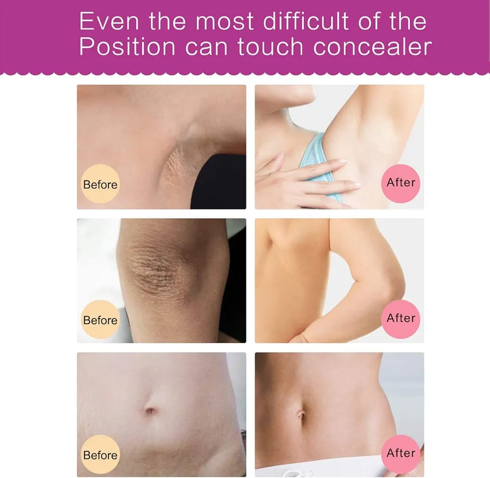 🌸 Crema Blanqueadora y Reparadora para Axilas, Codos, Rodillas y Zonas Íntimas – 60 ml